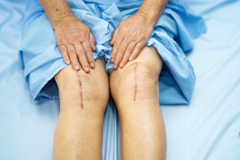 5 Tips for Successfully Managing Post-Surgical Pain